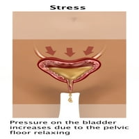 Stres inkontinencije Poster Print by Gwen Shockey Science izvor